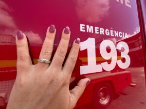 Imagem da notícia - Em Manaus, mais de 400 pessoas são socorridas, por ano, com anéis presos aos dedos